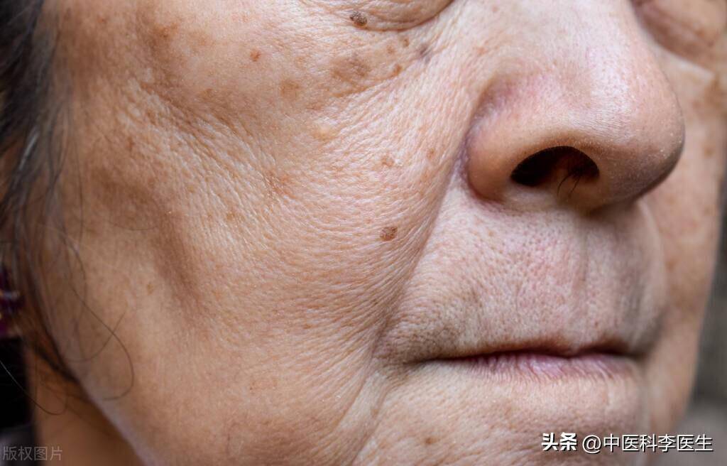 鼻尖青——鼻头泛青色,伴有鼻腔发干,流清鼻涕等症状