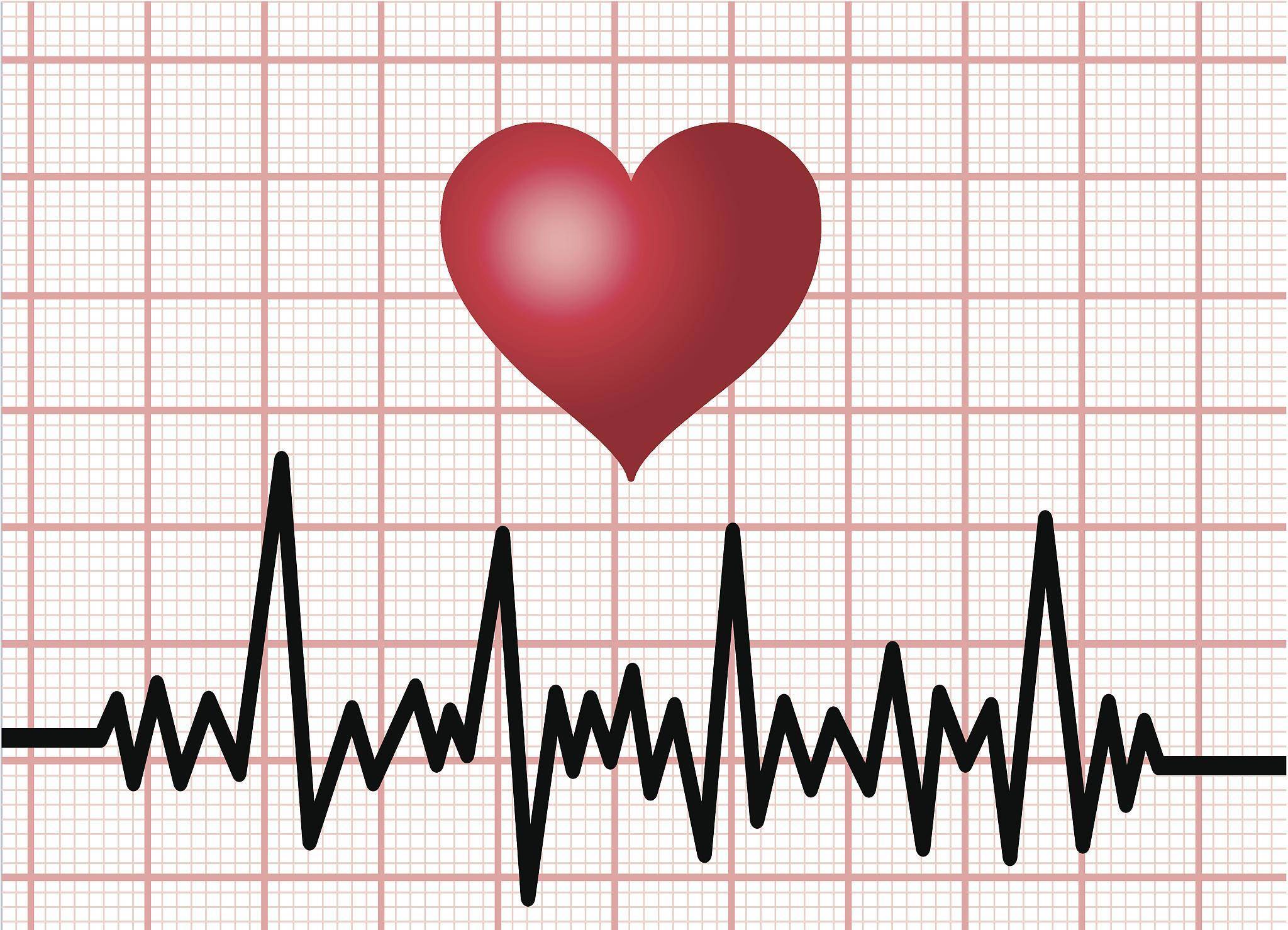 说自己值完夜班后出现室性早搏二联律,三联律,担心自己早搏太多了,想