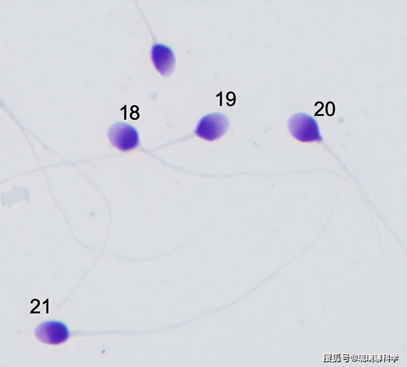 石楠花为什么是精子味（石楠花为什么很臭） 第6张