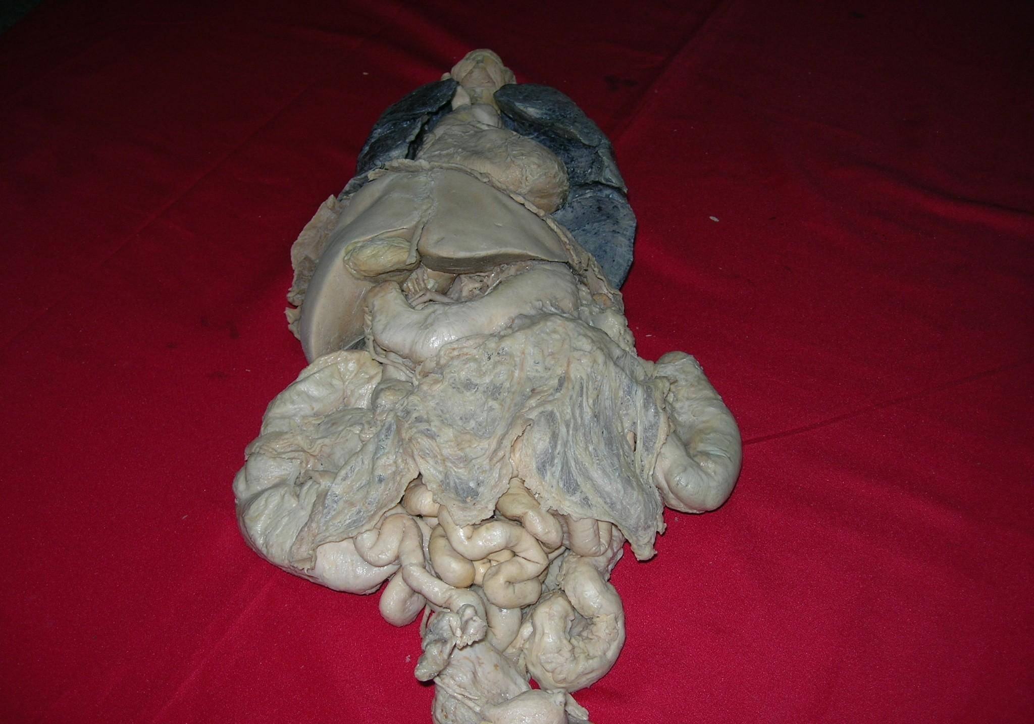 这是一副完整的女性内脏标本,各个内脏器官的大小,位置及比例情况一目