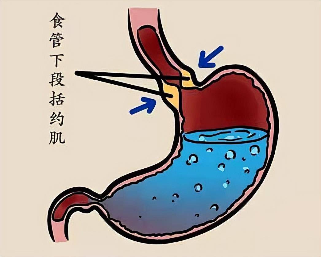 背后可能藏着大隐患_食管_食物_胃酸