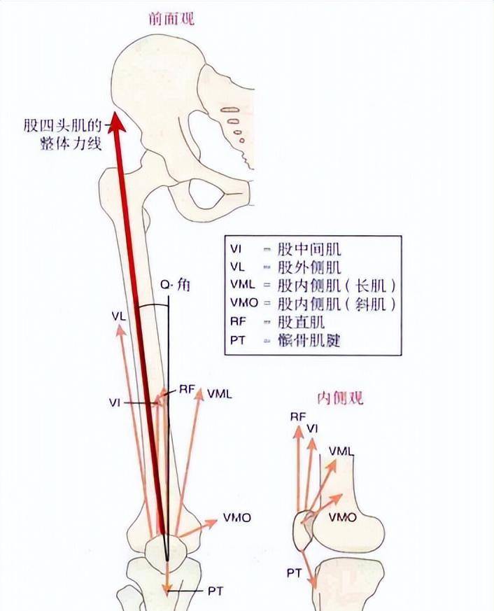 形成q角,q角正常范围为170-162度,q角的存在会产生使髌骨向外的拉力
