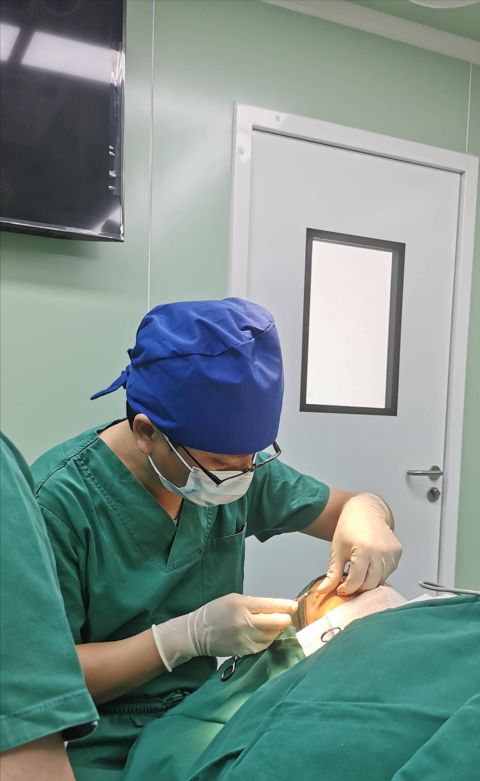 49岁来北京做了筋膜悬吊提眉手术,术后13天每一天恢复细节反馈