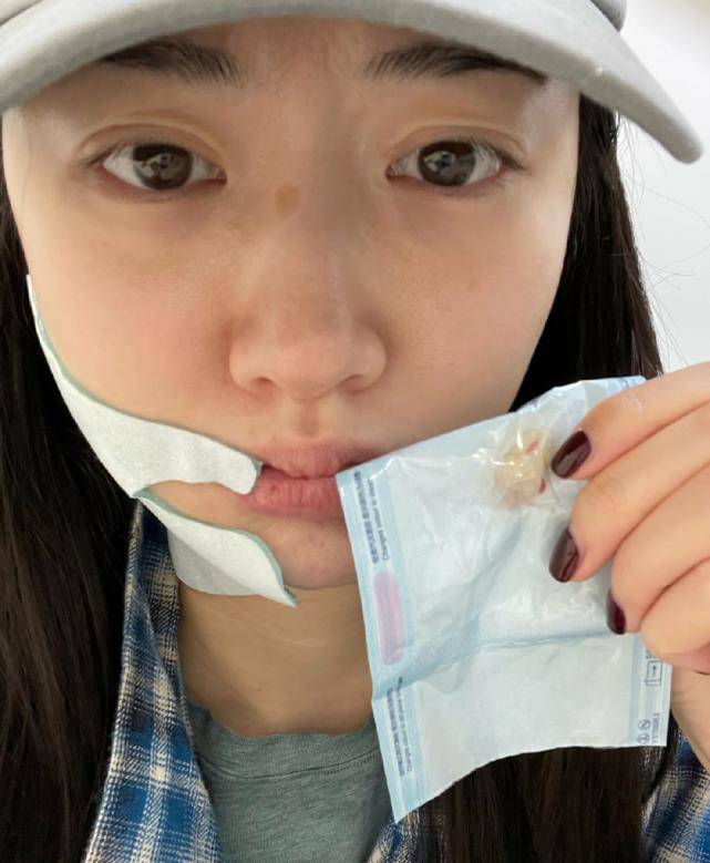 晒素颜照,双眼皮手术痕迹明显,曾坦言十分后悔整容_合作_眼睛_前景