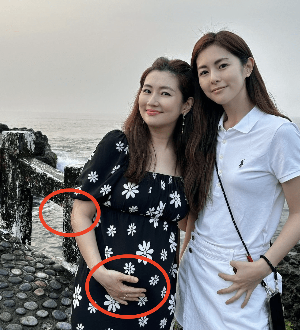 《我和春天有个约会》时,片场着火,selina全身54%严重烧伤,俞灏明的
