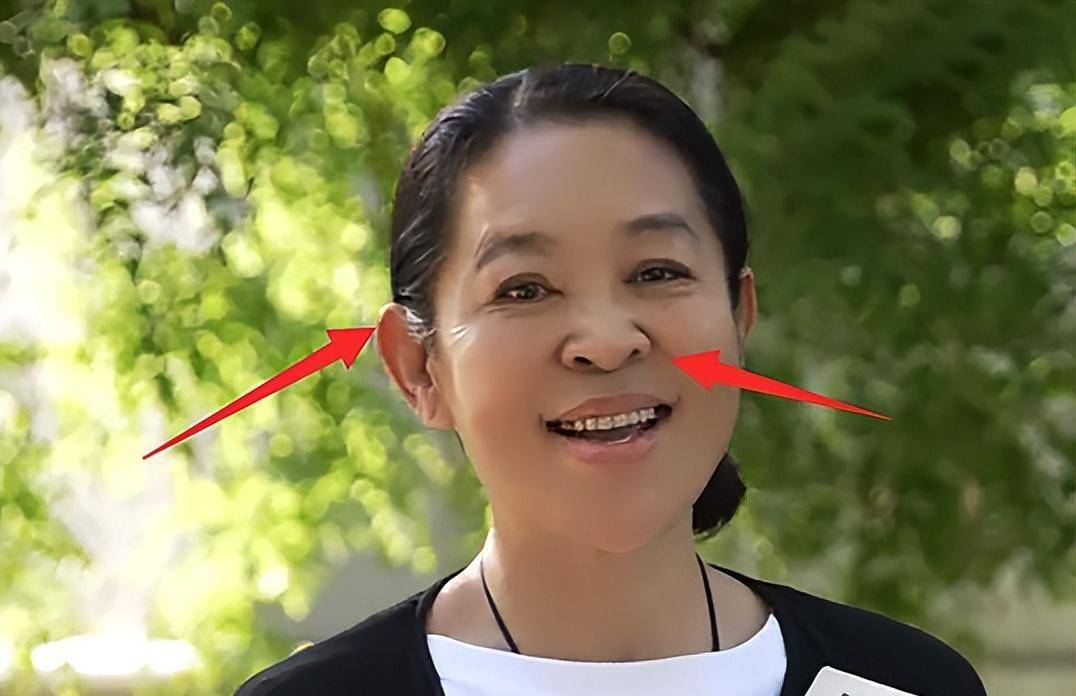 64岁倪萍整容大变样,"倒三角"下巴又尖又长,脸僵硬不自然_网友_时候