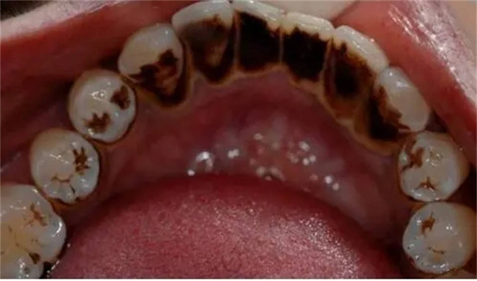 牙齿_牙粉_因为