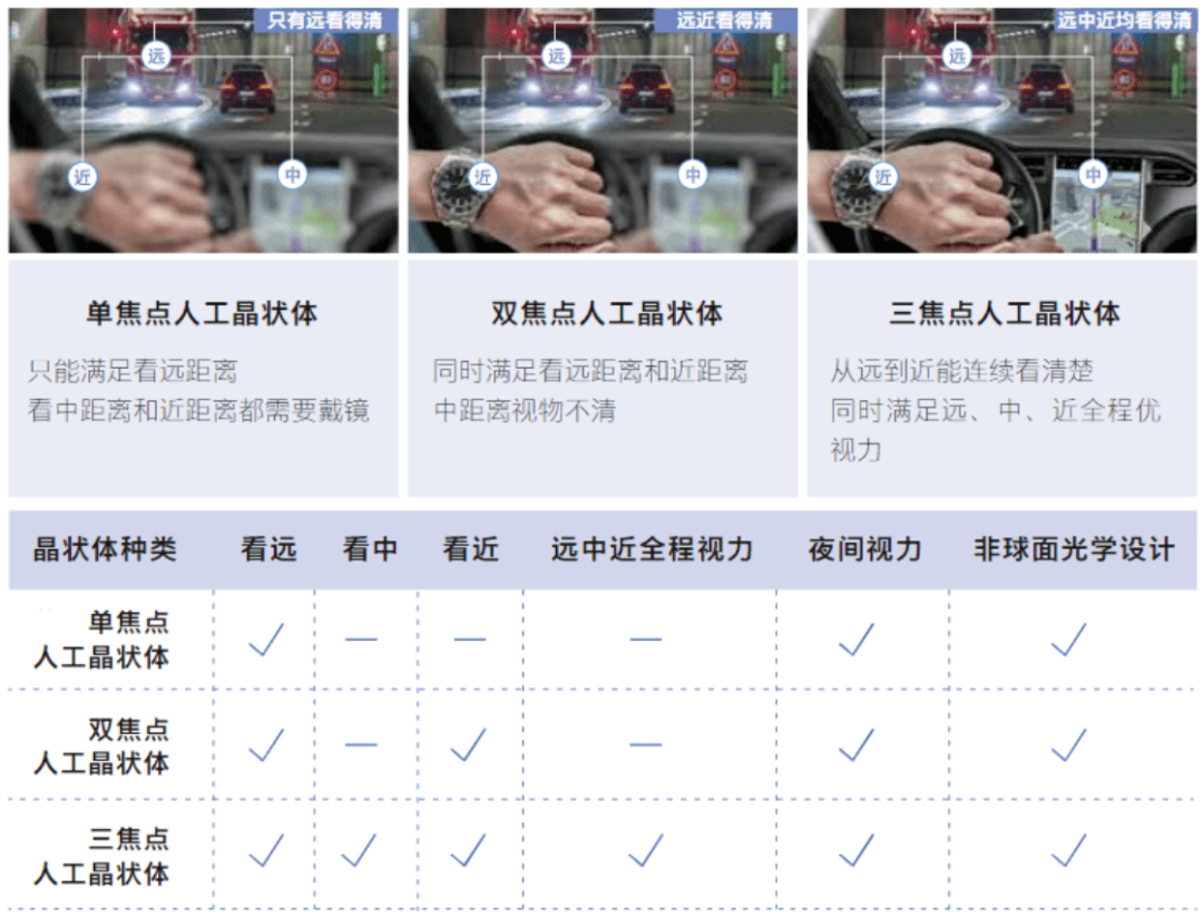 三焦点人工晶状体植入,助患者重获远中近全程视力