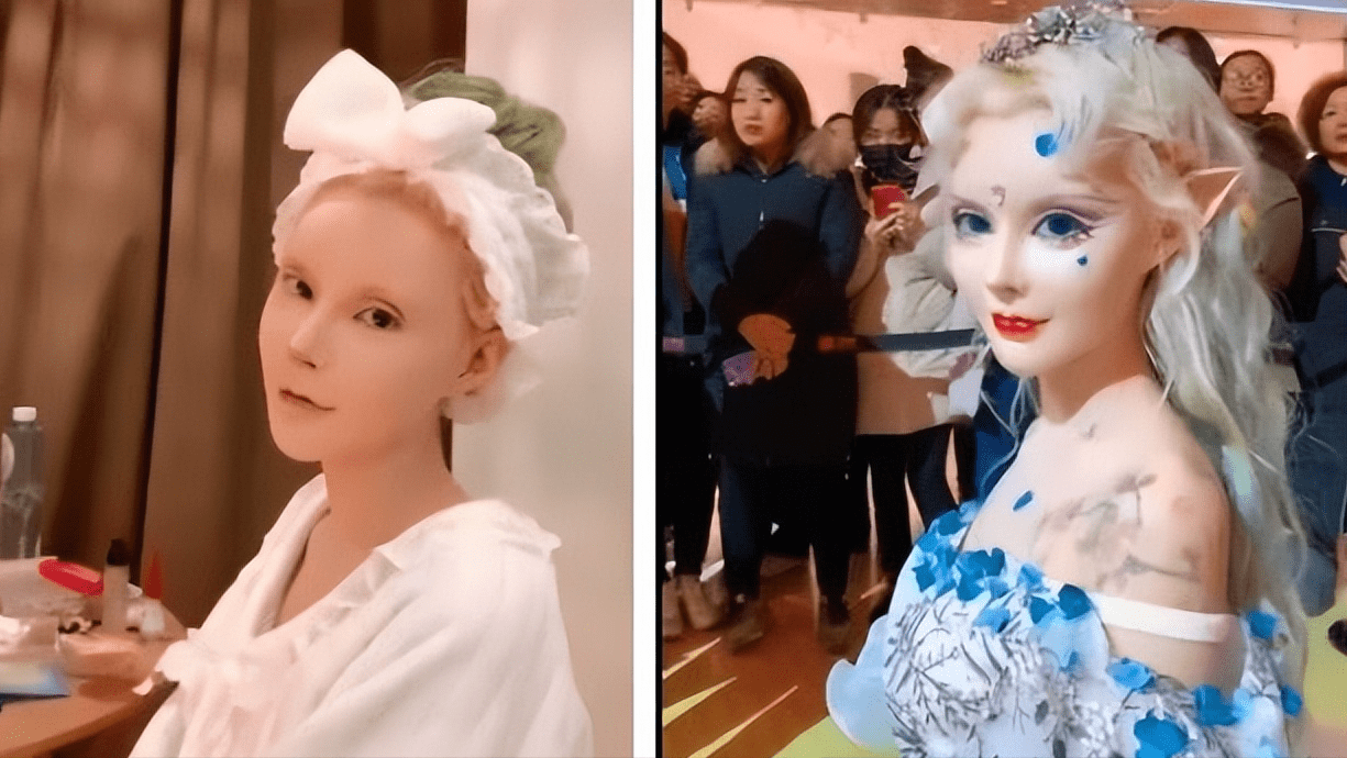 脸上动108刀,吃饭不敢张嘴,还坚称自己没整容,迪丽拉还有救吗_影响