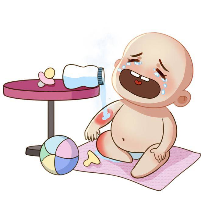 宝宝烫伤如何处理和预防