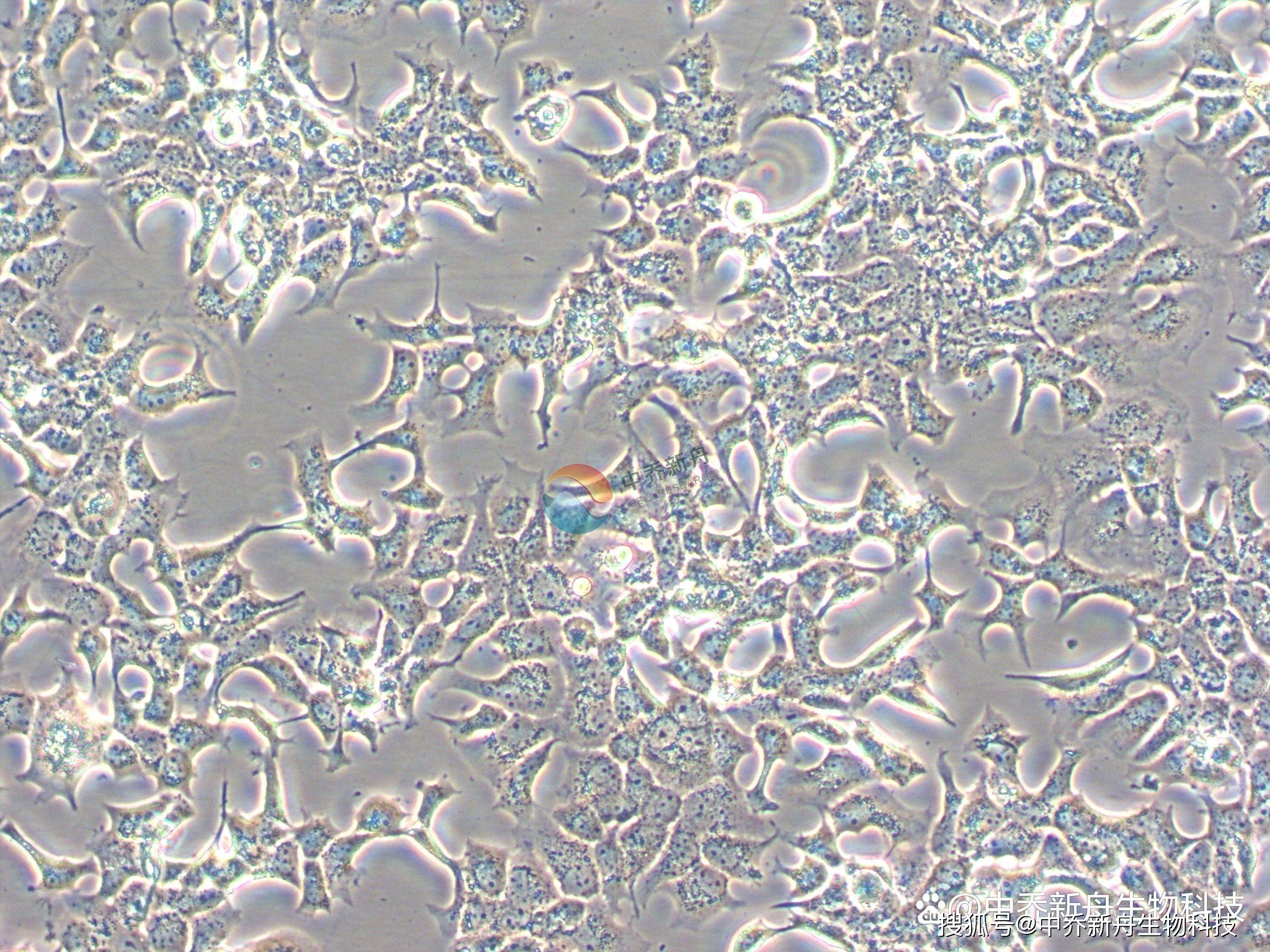 高效培养bt-474细胞,这篇笔记一定不能错过_培养皿_培养基_微镜