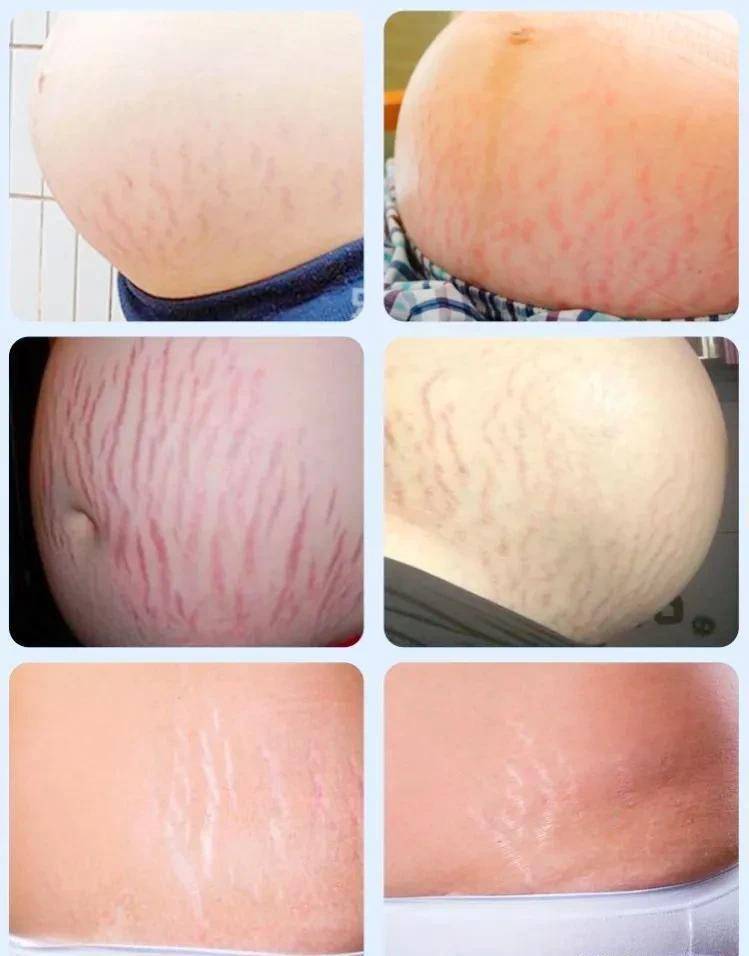 到底是怎么回事?_孩子_肚子_镜头