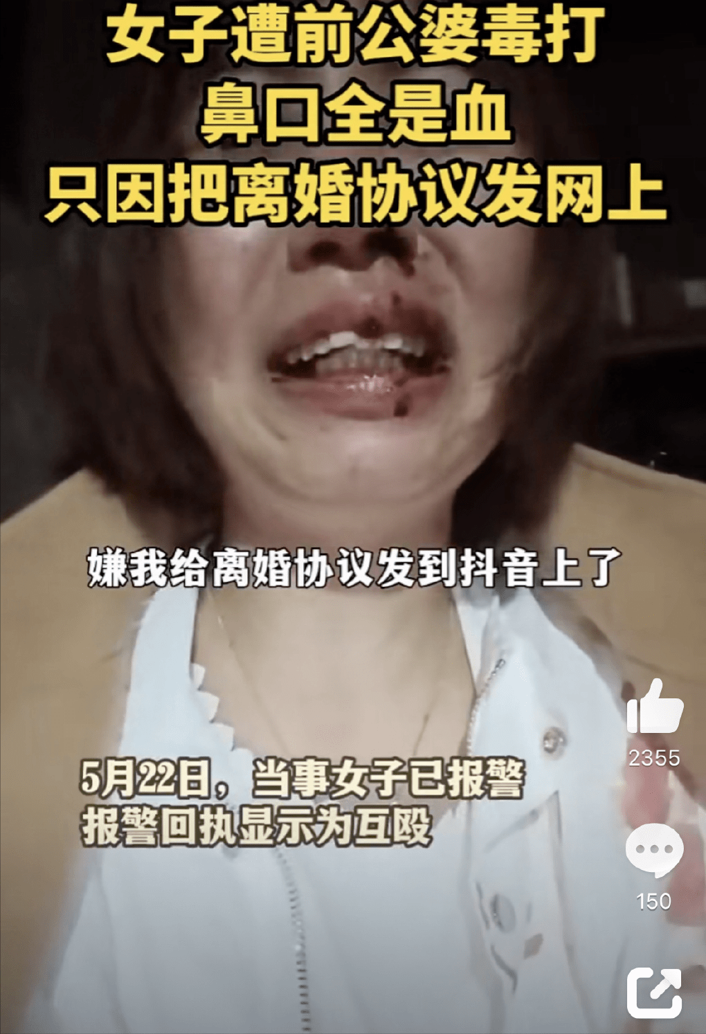 女子把离婚协议发网上遭前公婆殴打,原因竟是给他们丢人了