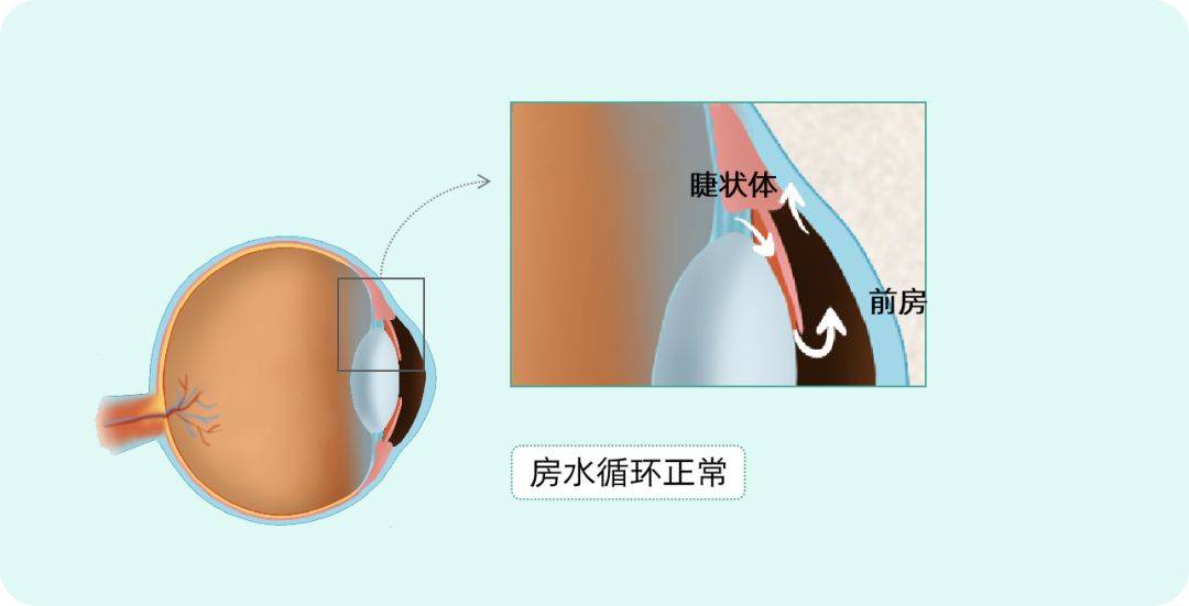 眼睛房水位置图片图片