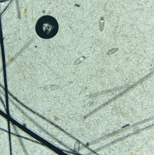 莫爱佳皮肤关爱月病例回顾——猫戈托伊蠕形螨感染,浅表性脓皮病的诊