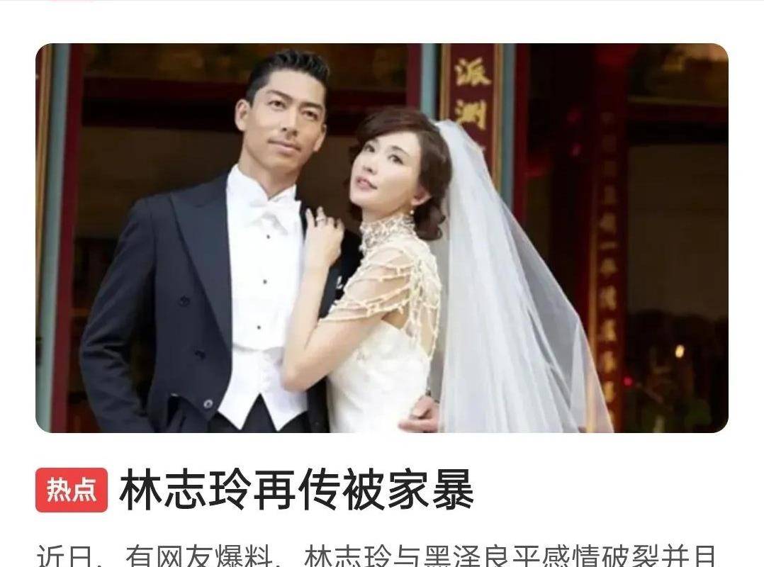 林志玲被家暴?这么漂亮的女人,你黑泽良怎么下得去手!