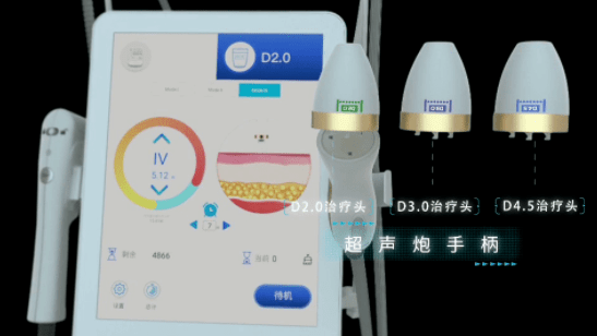 实话实说：超声炮有副作用吗？超声炮的副作用和危害！-一台超声炮价格