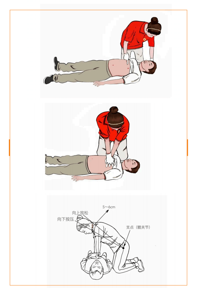 心肺复苏正确体位图片图片