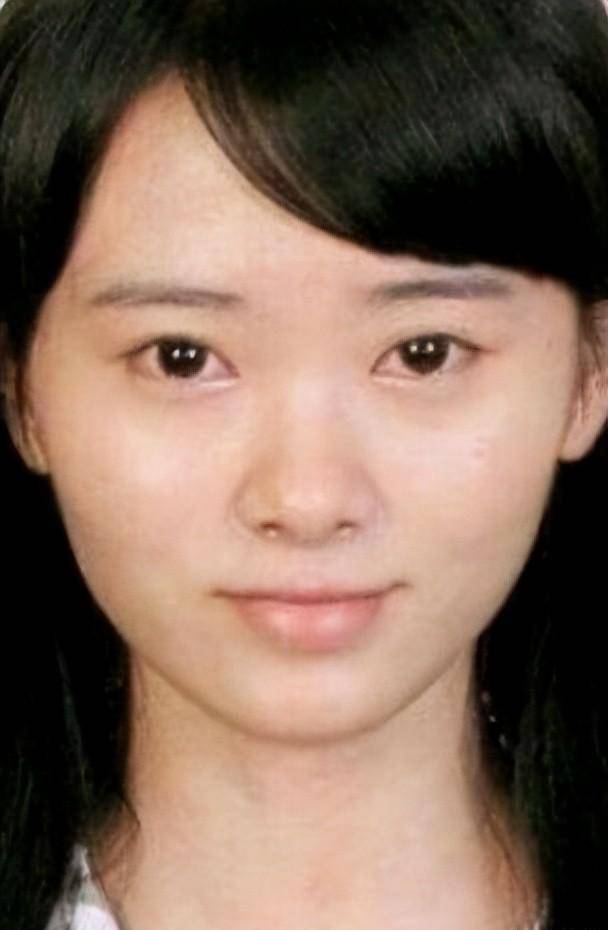 为什么明星整容越来越美,有辨识度,普通人整容网红脸?