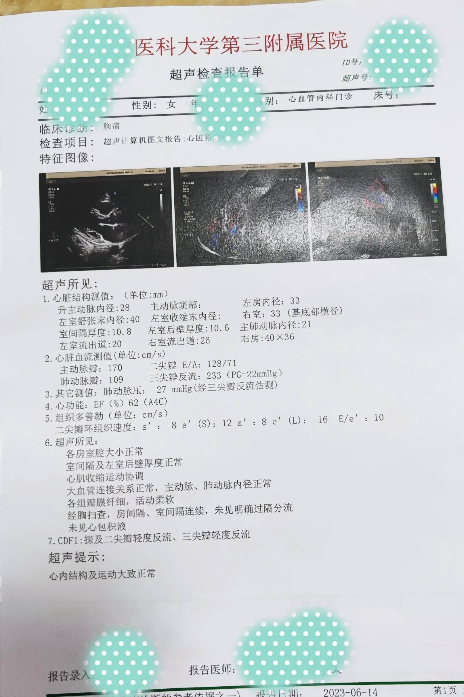 左房轻度扩大超声提示:报告日期2022_06_27(一)2022年接着我们再来