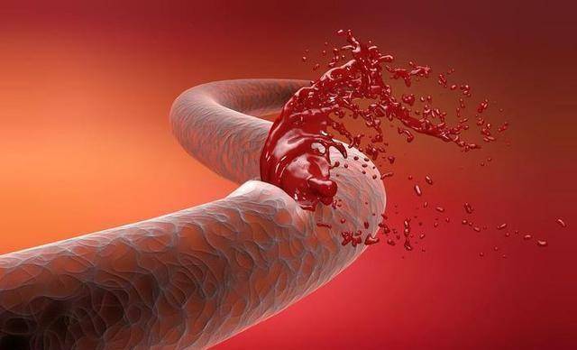 知名影后因脑出血心脏骤停,手术也未挽回生命,为何会如此?