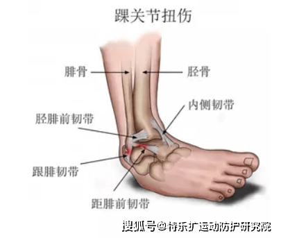 跑步腓骨疼图片