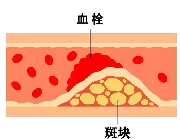 若肚子出现5种特征,可能是癌症前兆