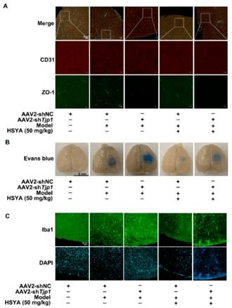 zo-1 protein in cerebral microvascular endothelium的文章,作