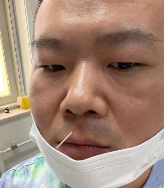 岳云鹏烧饼同台演出,走错门头撞墙上,新发型被调侃像是"卤蛋"_相声