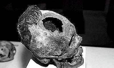 开颅钻孔手术,在古代早已存在,这个发现就是证据_头颅_事情_因为