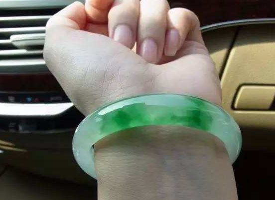 手腕绿色血管图片