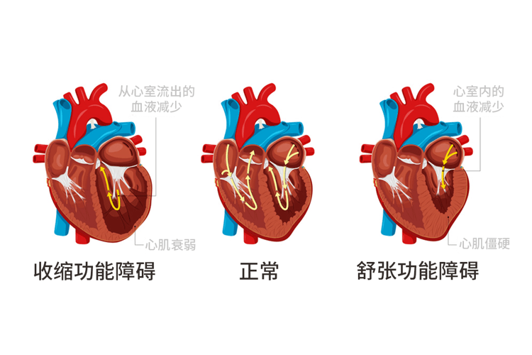 心脏射血动画图片