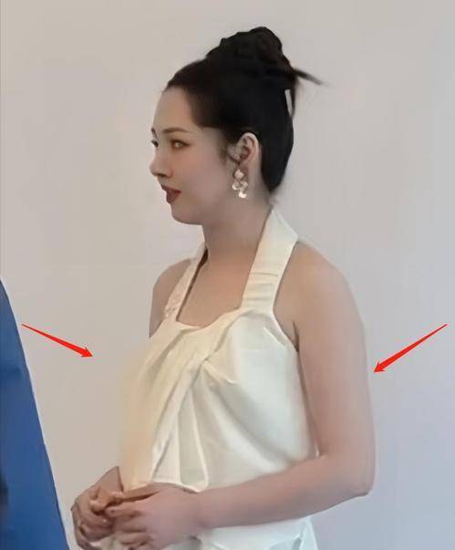 郭碧婷发胖50斤!