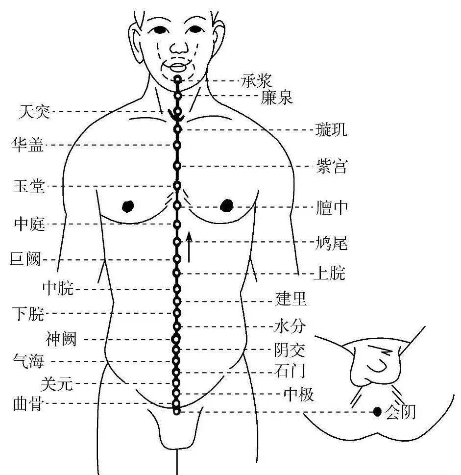 任督二脉图放大图片