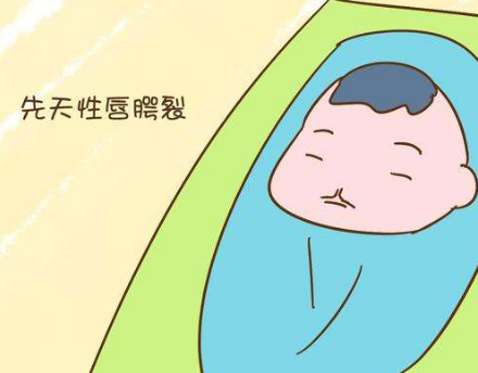 孕期服药生下"兔唇宝宝",孕妈做事要顾及胎儿,千万别大意!