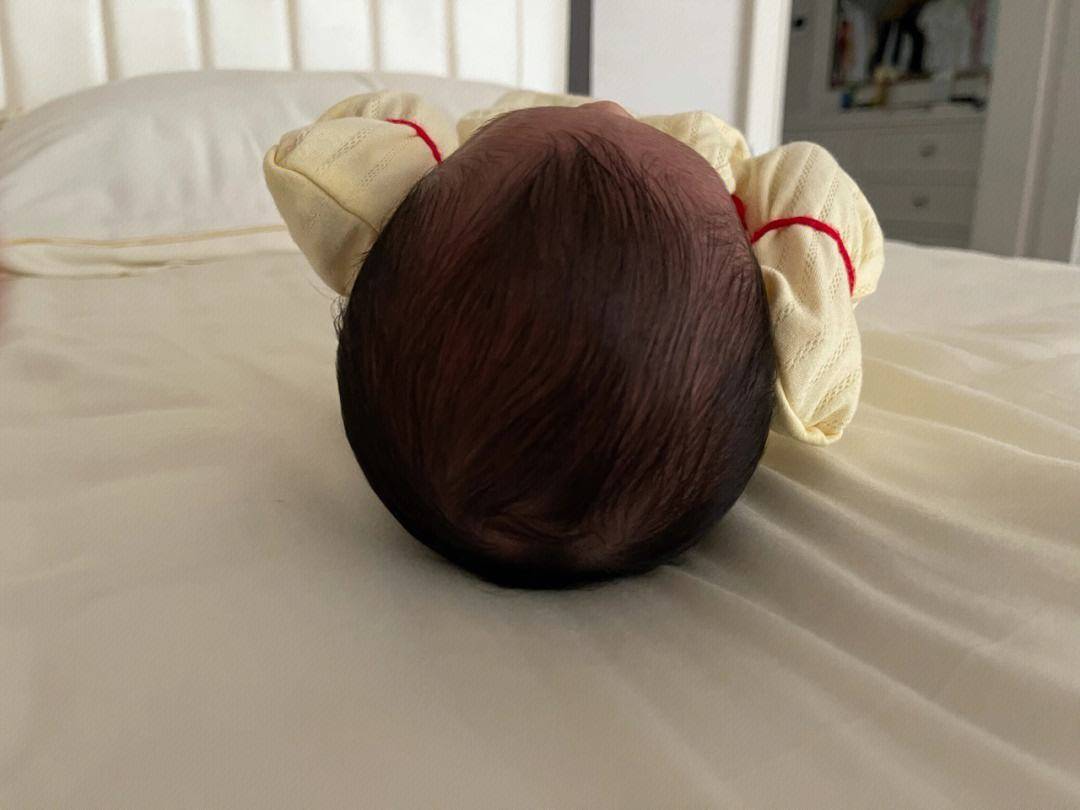 因为如果宝宝一直侧睡的话,会导致头部后侧变长,从而形成舟状头