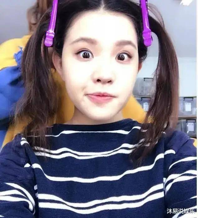 谢依霖大方承认十年前整容,现在鼻子像节拍器!