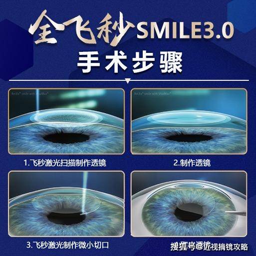 杭州眼科医院全飞秒多少钱?