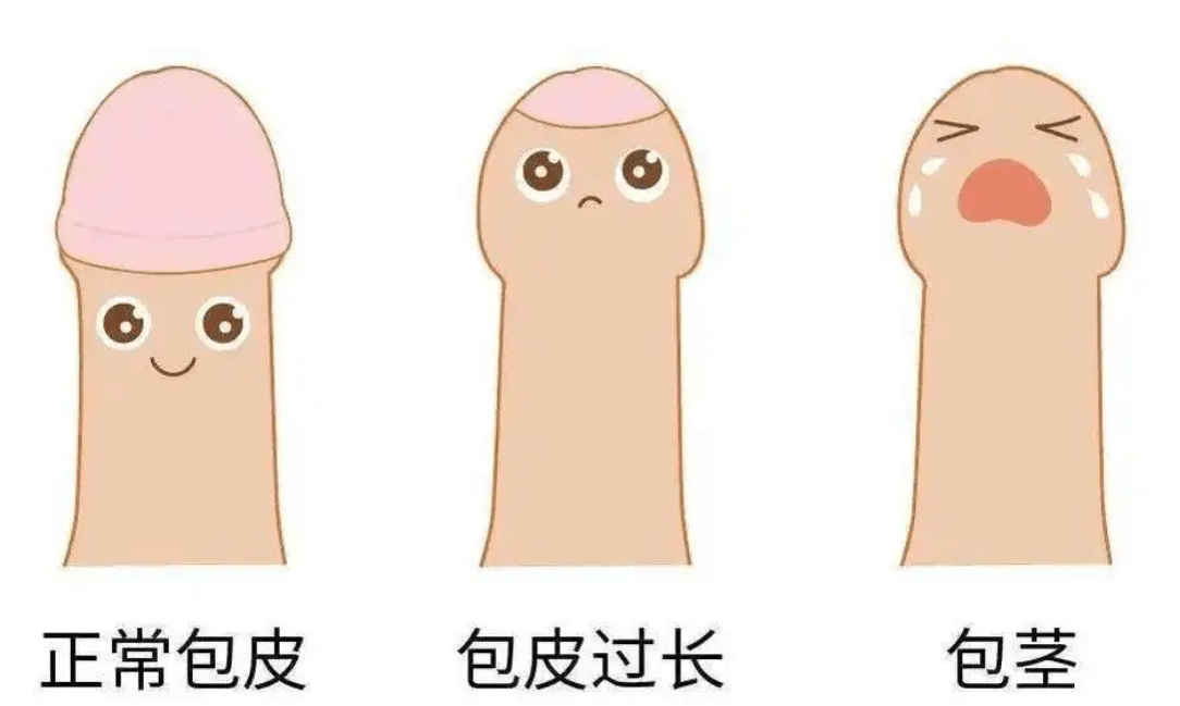 但是你依然可以折断它,如果你不小心折到它,就是丁丁骨折