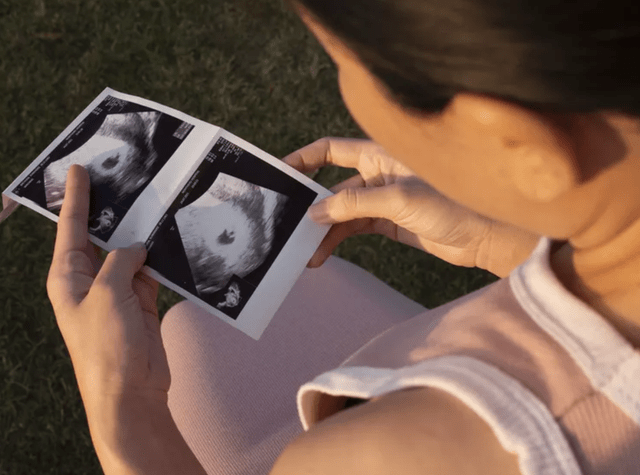 怀孕5个月胎儿图真实图片