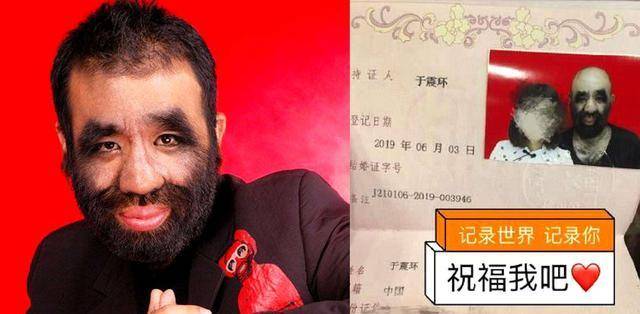 还记得43年前的"毛孩"于震寰吗?曾火遍全国,现在过得怎么样?