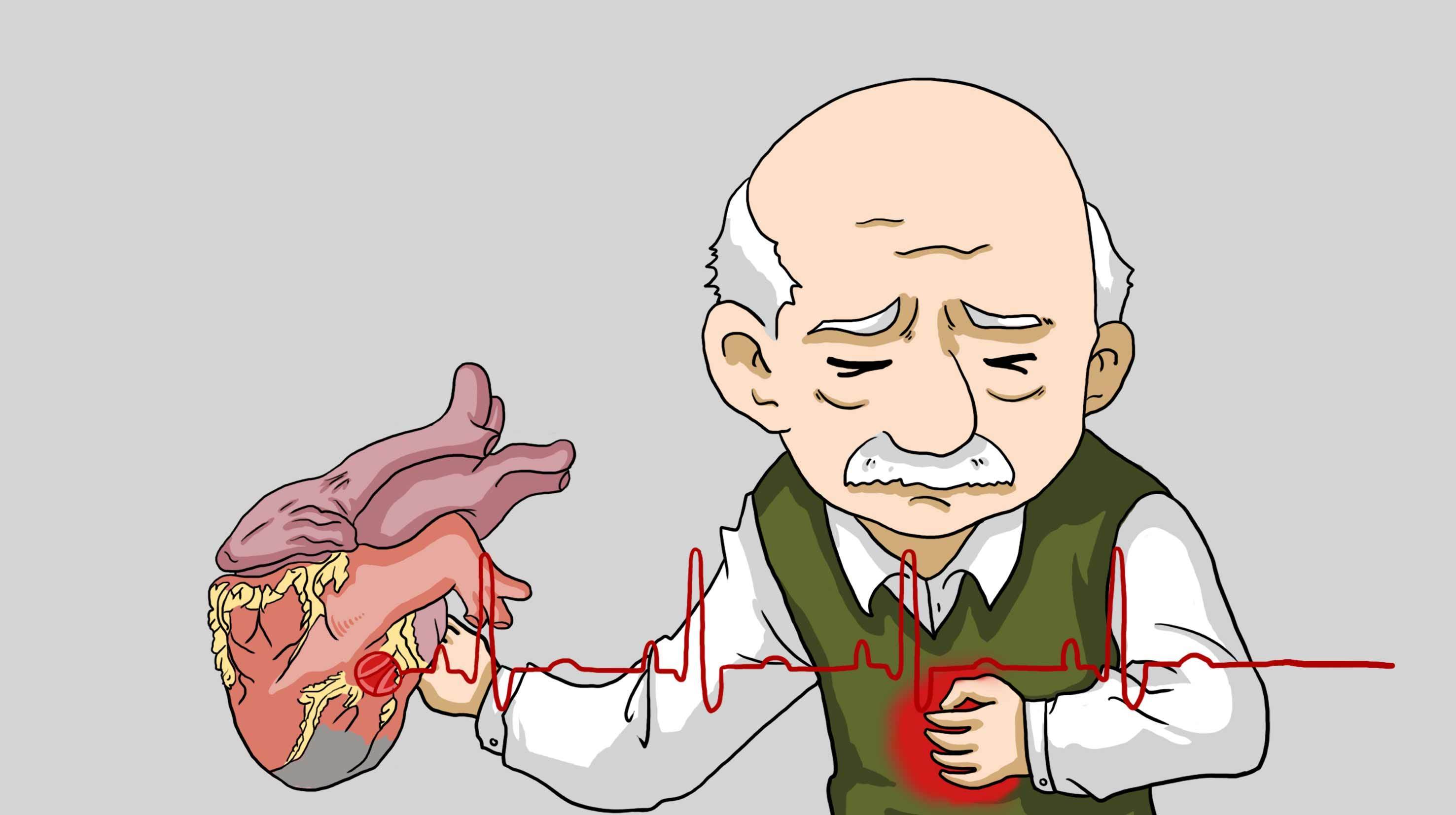 发生急性胸痛怎么办?早期快速识别是救命关键!记牢4条救治原则!