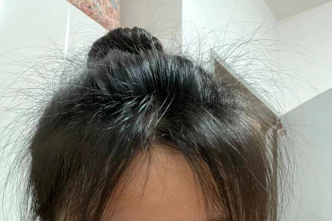 按摩_产品_头顶