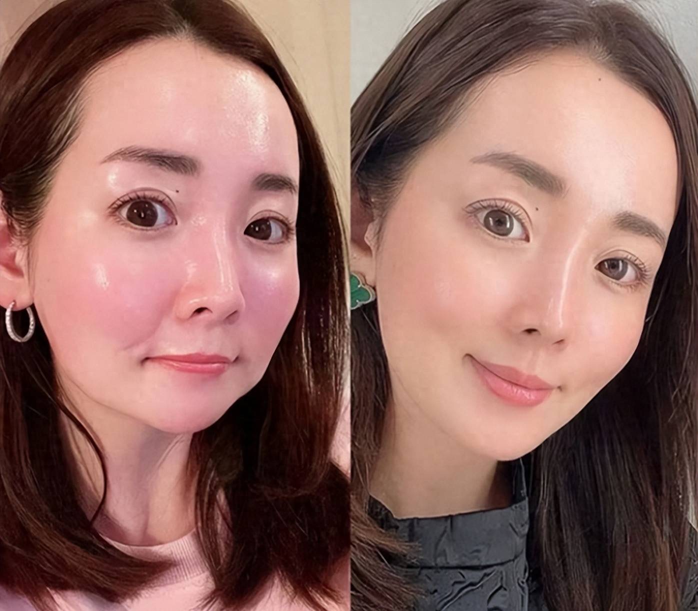 看杨紫,娄艺潇就知道,多影响颜值_面部_自然_效果