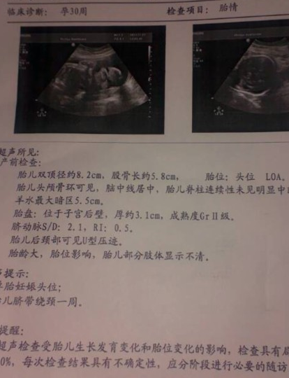 解读,但是医生看完后通常只会告诉我们胎儿的发育情况,并不会逐一解读