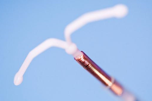 女人"上环"避孕,会影响身体?