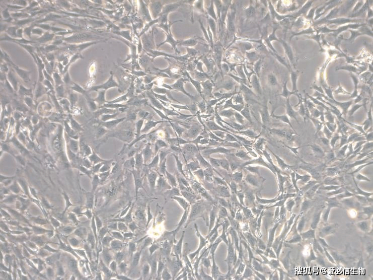 3t3-l1细胞培养及经典"鸡尾酒"诱导攻略_培养基_染色_脂肪