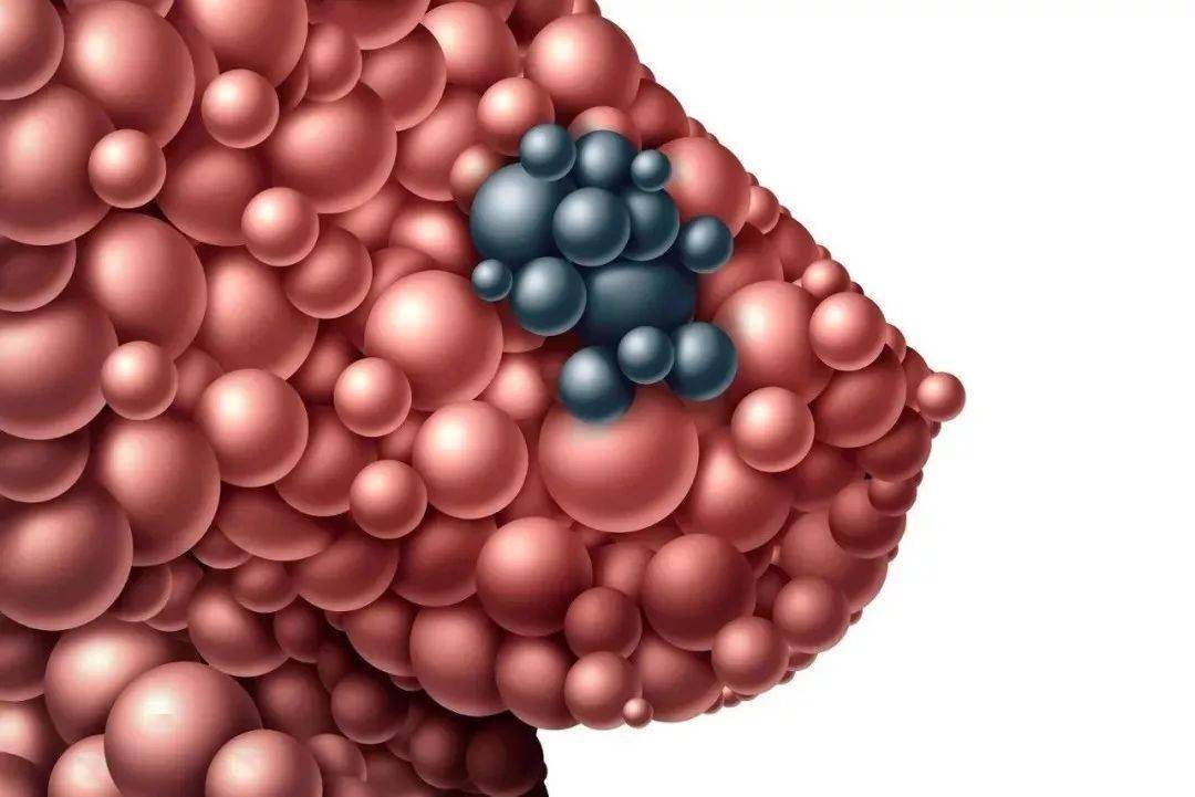 乳腺结节和甲状腺结节吃采宁结通都有用吗?_异物感_咽喉部_身体