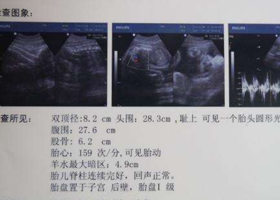 两周孕检报告单图片图片