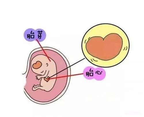 怀孕11周胎儿b超图图片